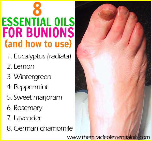 Discover 8 best essential oils for bunions and how to use for a natural solution to dissolve them fast! 