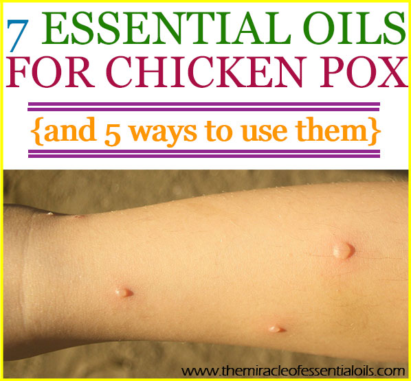 Top 7 Essential Oils for Chicken Pox & 5 Ways to Use them