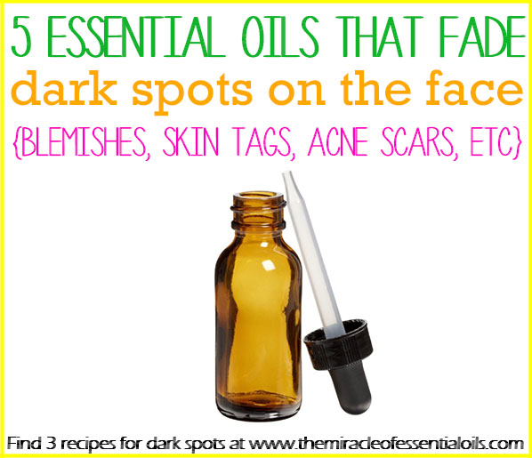 Top 5 Essential Oils for Dark Spots on the Face