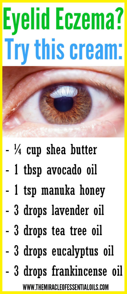 Check out these essential oils for eczema on eyelids to find natural relief fast. 