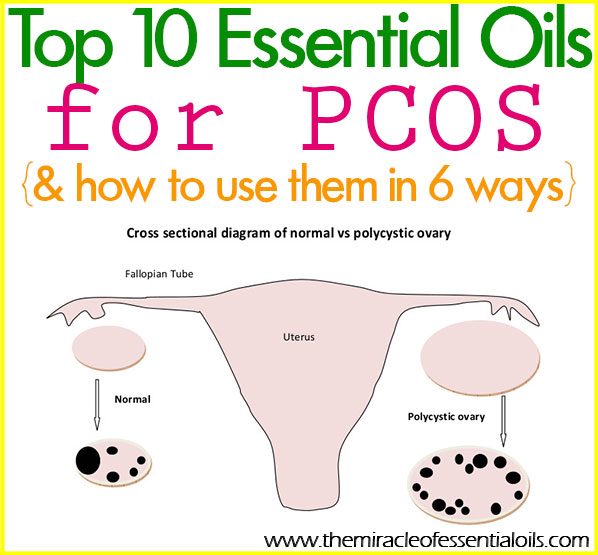  Try using essential oils for PCOS to naturally support your healing journey. Essential oils can help treat your symptoms and increase fertility!