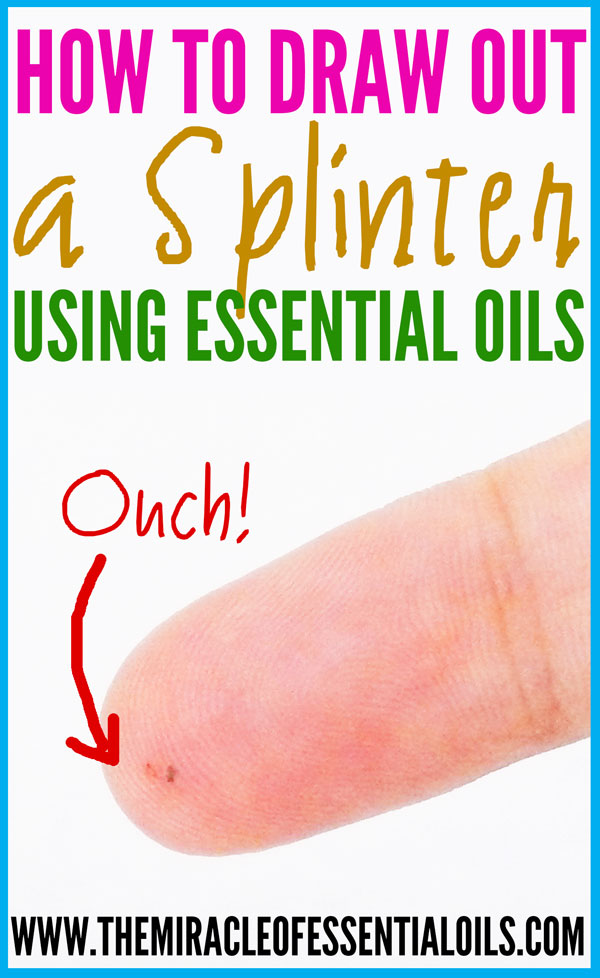 Learn how to draw out a splinter with essential oils! 