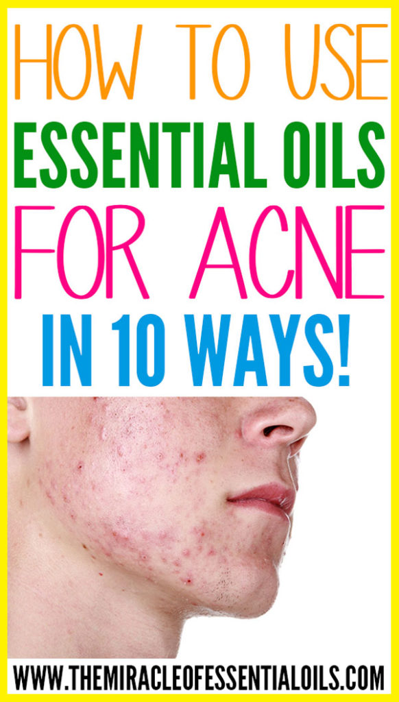 Okay, onto the main part of this article - how to use essential oils for acne! There are several ways you can use essential oils for acne! Check them out below! These are our favorite ways and they sure are very effective in getting risk of pesky pimples!