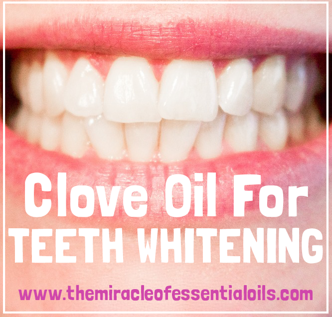 How To Use Clove Oil For Tooth Whitening