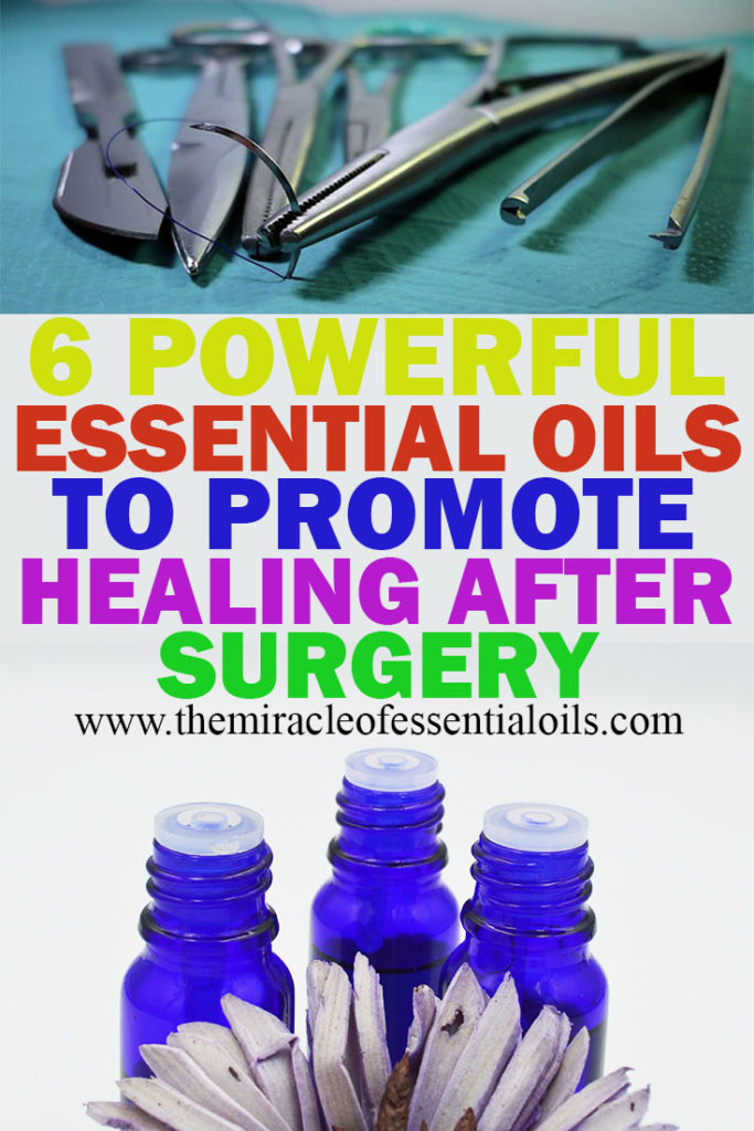 6 Best Essential Oils to Promote Healing After Surgery The Miracle of Essential Oils