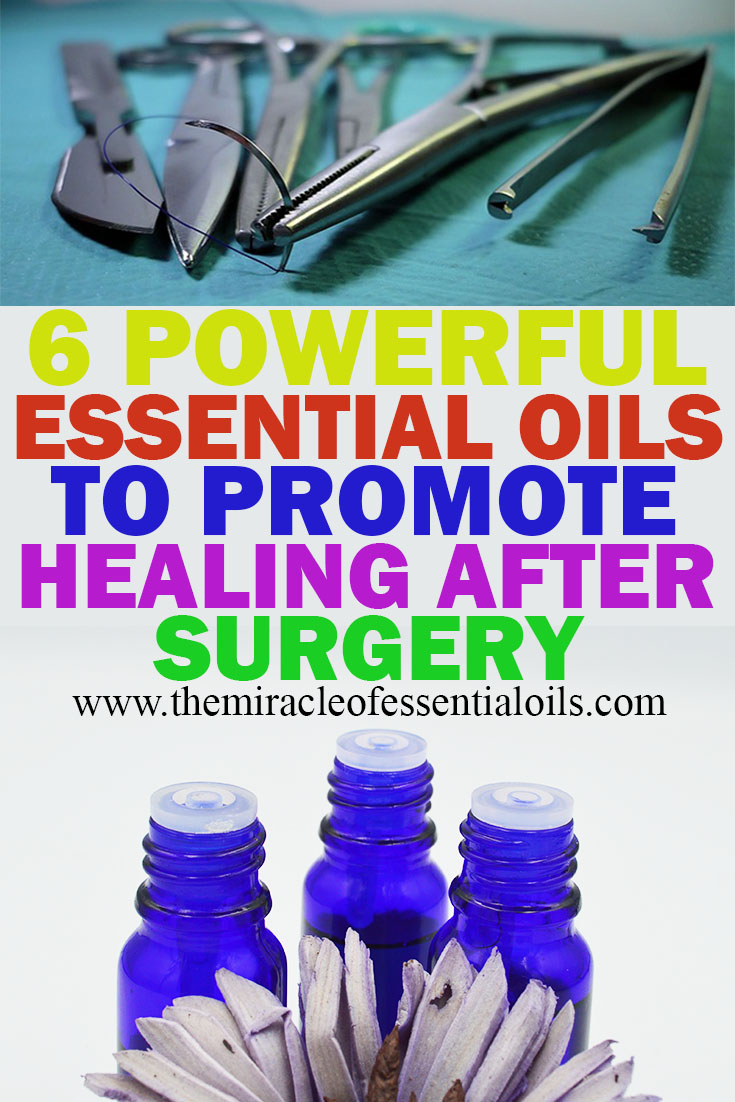 6 Best Essential Oils to Promote Healing After Surgery