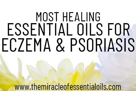 essential oils for eczema and psoriasis