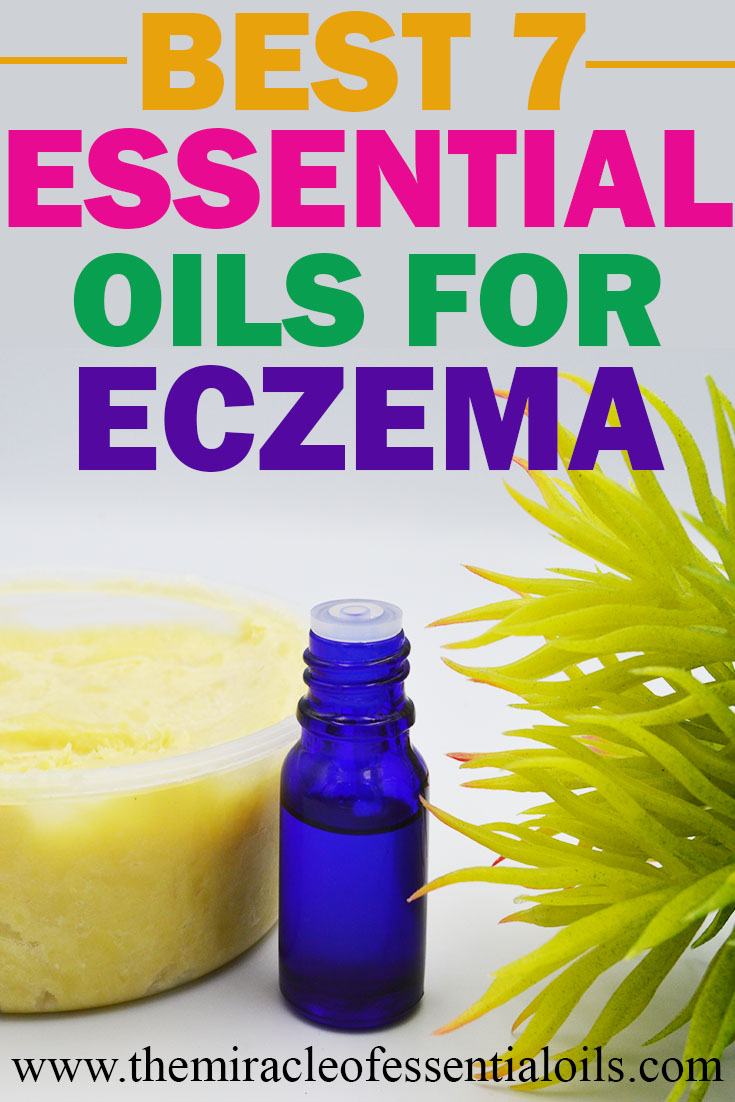 essential oils for severe eczema